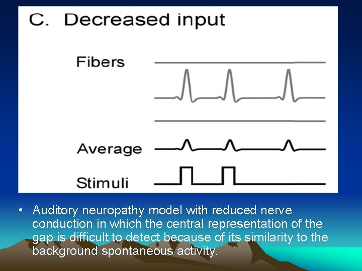  • Auditory neuropathy model with reduced nerve conduction in which the central representation