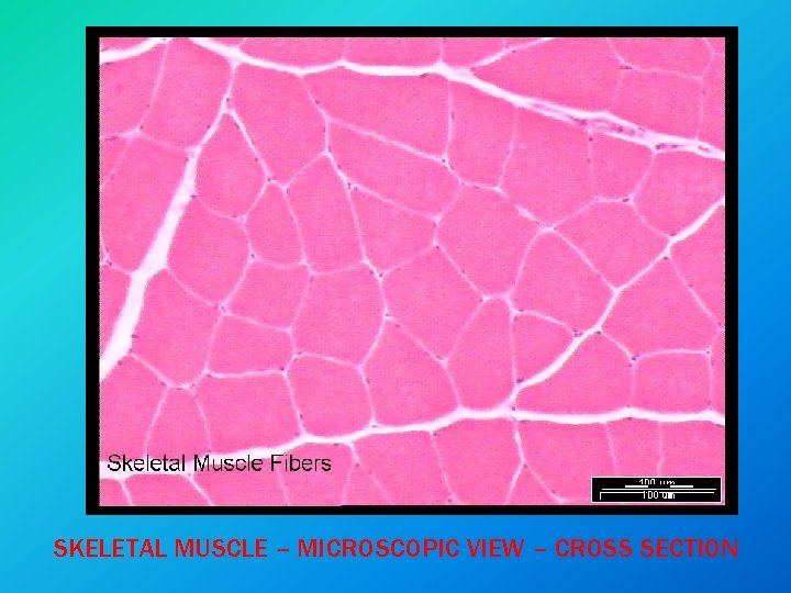 SKELETAL MUSCLE – MICROSCOPIC VIEW – CROSS SECTION 