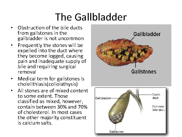The Gallbladder • Obstruction of the bile ducts from gallstones in the gallbladder is