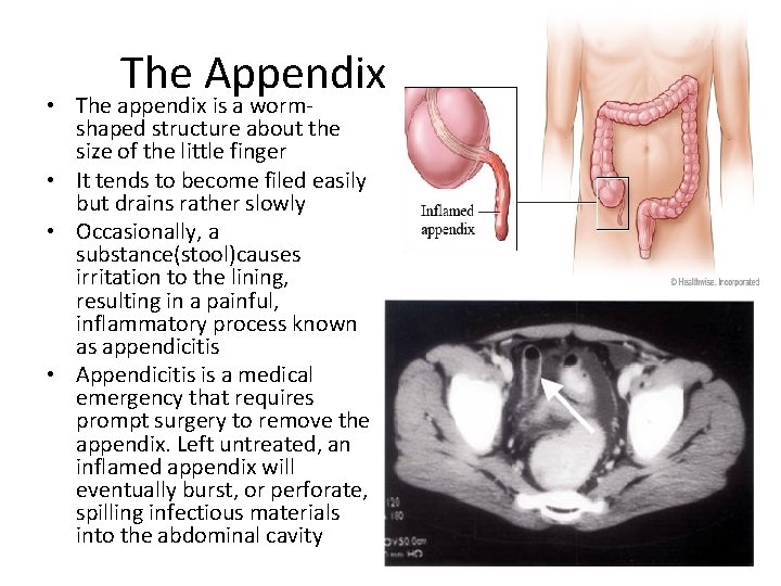 The Appendix • The appendix is a wormshaped structure about the size of the