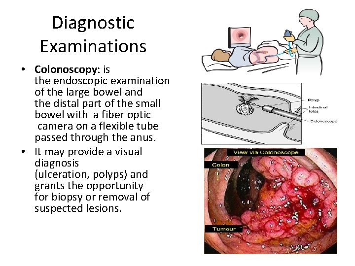 Diagnostic Examinations • Colonoscopy: is the endoscopic examination of the large bowel and the