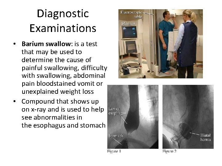 Diagnostic Examinations • Barium swallow: is a test that may be used to determine