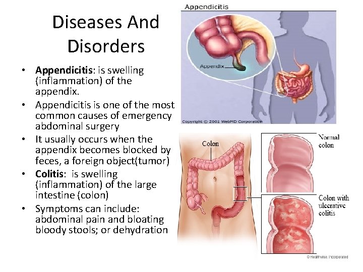 Diseases And Disorders • Appendicitis: is swelling (inflammation) of the appendix. • Appendicitis is