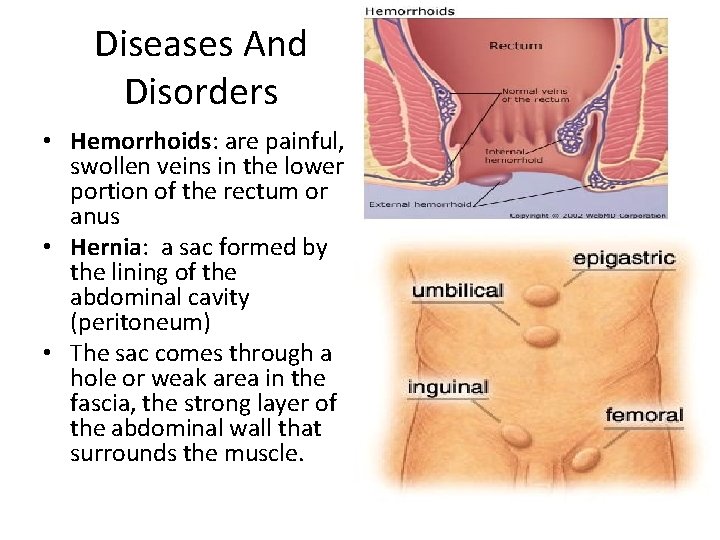 Diseases And Disorders • Hemorrhoids: are painful, swollen veins in the lower portion of