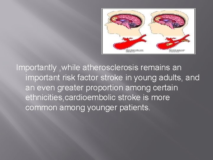 Importantly , while atherosclerosis remains an important risk factor stroke in young adults, and