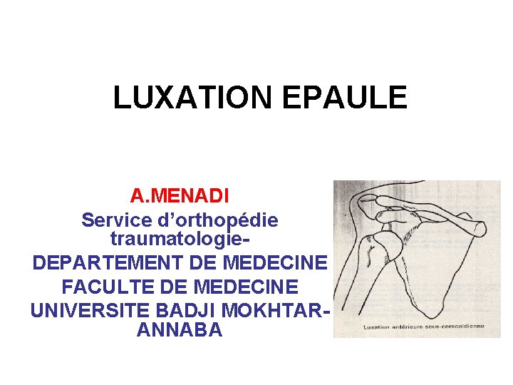 LUXATION EPAULE A. MENADI Service d’orthopédie traumatologie. DEPARTEMENT DE MEDECINE FACULTE DE MEDECINE UNIVERSITE