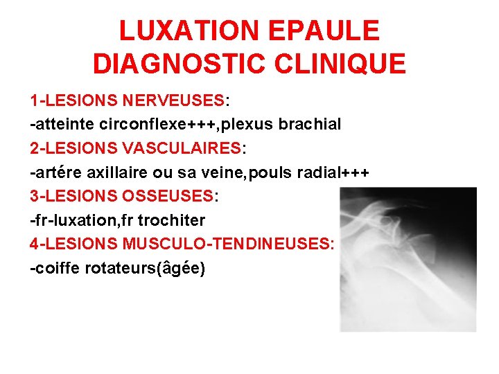 LUXATION EPAULE DIAGNOSTIC CLINIQUE 1 -LESIONS NERVEUSES: -atteinte circonflexe+++, plexus brachial 2 -LESIONS VASCULAIRES: