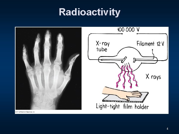 Radioactivity 4 