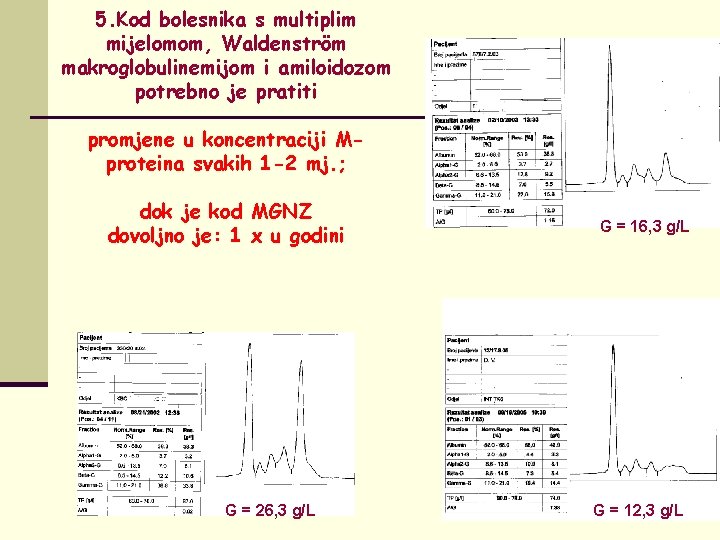 5. Kod bolesnika s multiplim mijelomom, Waldenström makroglobulinemijom i amiloidozom potrebno je pratiti promjene