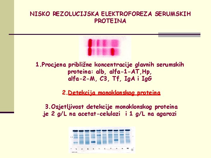 NISKO REZOLUCIJSKA ELEKTROFOREZA SERUMSKIH PROTEINA 1. Procjena približne koncentracije glavnih serumskih proteina: alb, alfa-1