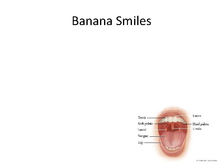 Banana Smiles 