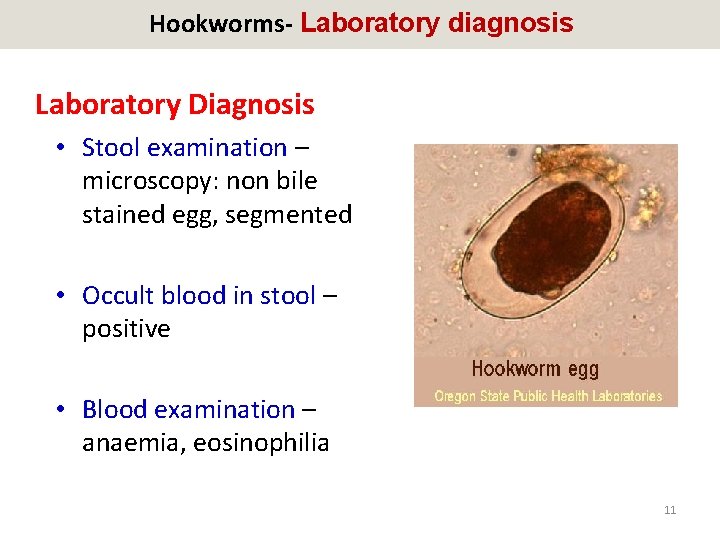 Hookworms- Laboratory diagnosis Laboratory Diagnosis • Stool examination – microscopy: non bile stained egg,