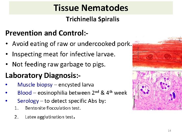 Tissue Nematodes Trichinella Spiralis Prevention and Control: • Avoid eating of raw or undercooked