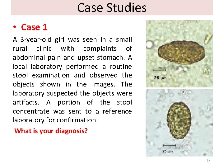 Case Studies • Case 1 A 3 -year-old girl was seen in a small