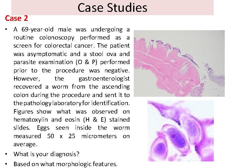 Case 2 Case Studies • A 69 -year-old male was undergoing a routine colonoscopy