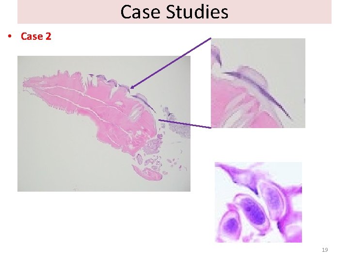 Case Studies • Case 2 19 