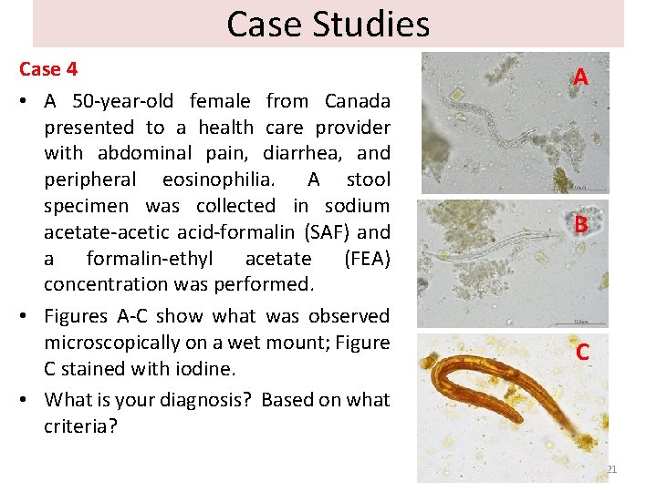 Case Studies Case 4 • A 50 -year-old female from Canada presented to a