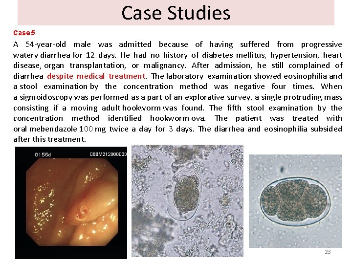 Case Studies Case 5 A 54 -year-old male was admitted because of having suffered