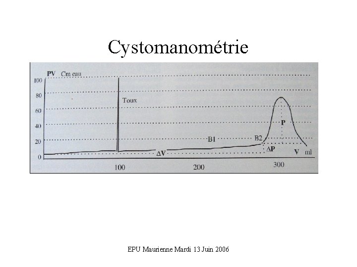 Cystomanométrie EPU Maurienne Mardi 13 Juin 2006 