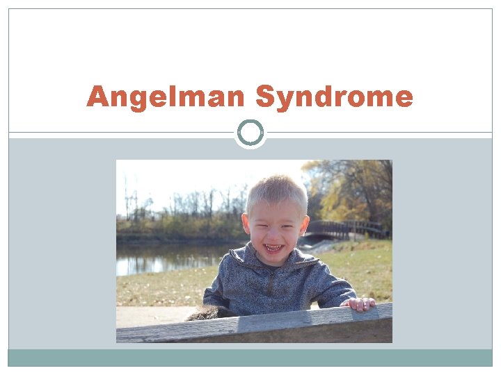 Angelman Syndrome 