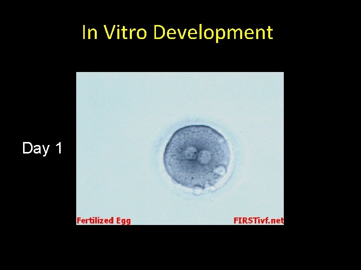 In Vitro Development Day 1 