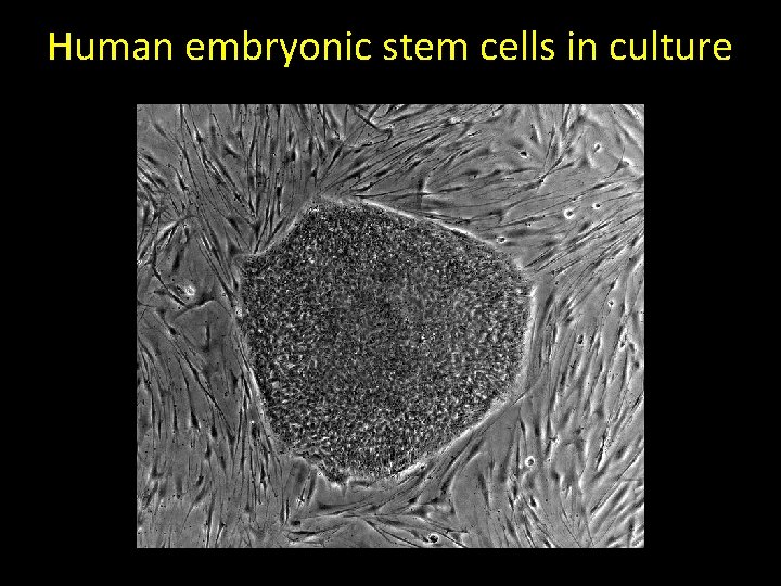 Human embryonic stem cells in culture 