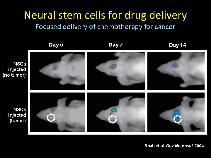 Neural stem cells for drug delivery Focused delivery of chemotherapy for cancer Day 0