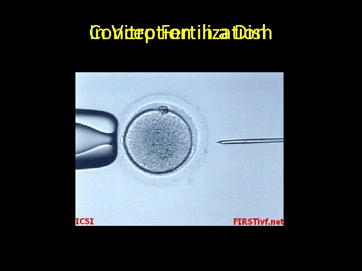 In Conception Vitro Fertilization in a Dish 