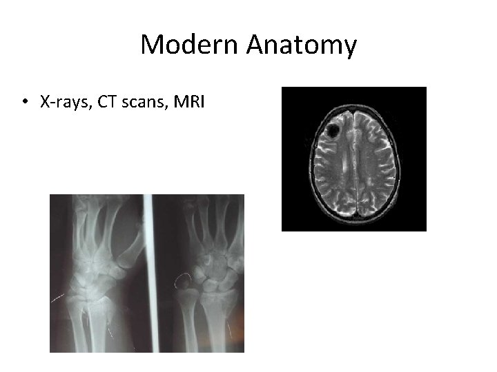 Modern Anatomy • X-rays, CT scans, MRI 