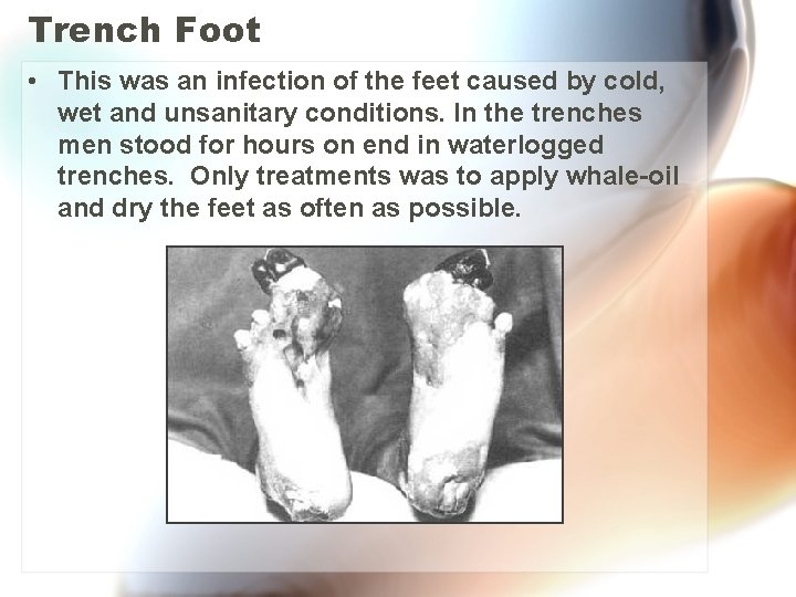 Trench Foot • This was an infection of the feet caused by cold, wet