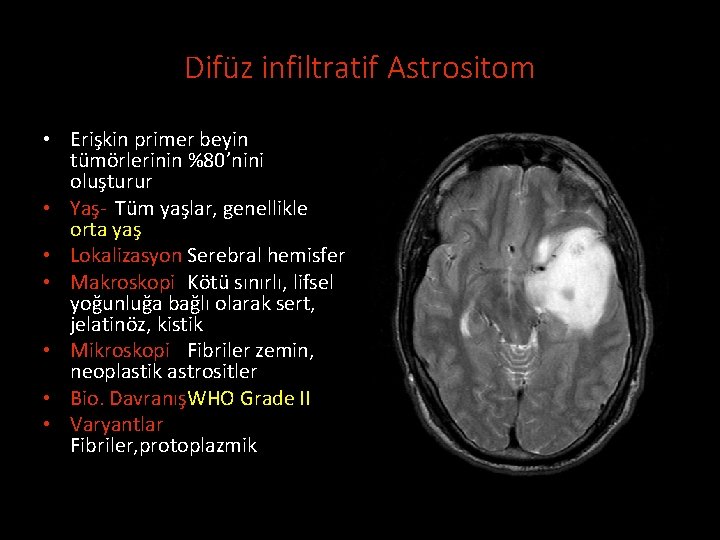 Difüz infiltratif Astrositom • Erişkin primer beyin tümörlerinin %80’nini oluşturur • Yaş- Tüm yaşlar,