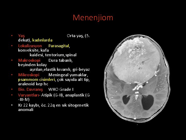 Menenjiom • • Yaş Orta yaş, (5. dekat), kadınlarda Lokalizasyon Parasagital, konveksite, kafa kaidesi,