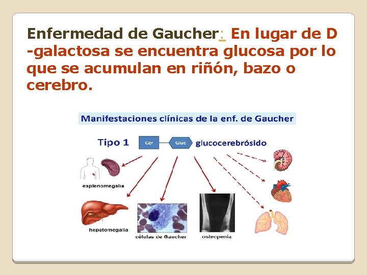 Enfermedad de Gaucher: En lugar de D -galactosa se encuentra glucosa por lo que Enfermedad de Gaucher: En lugar de D -galactosa se encuentra glucosa por lo que