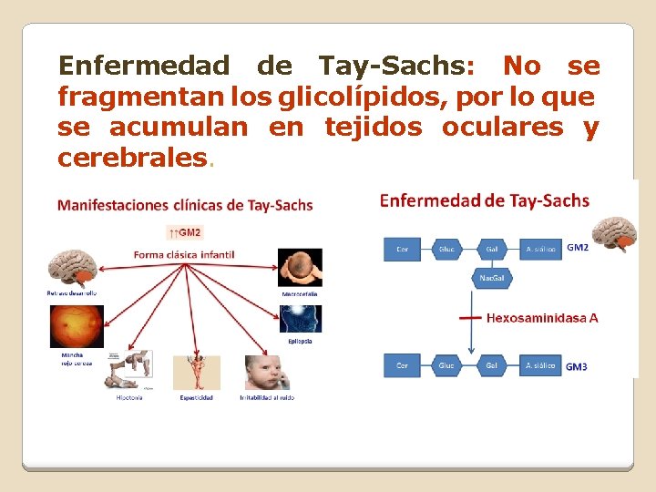 Enfermedad de Tay-Sachs: No se fragmentan los glicolípidos, por lo que se acumulan en Enfermedad de Tay-Sachs: No se fragmentan los glicolípidos, por lo que se acumulan en