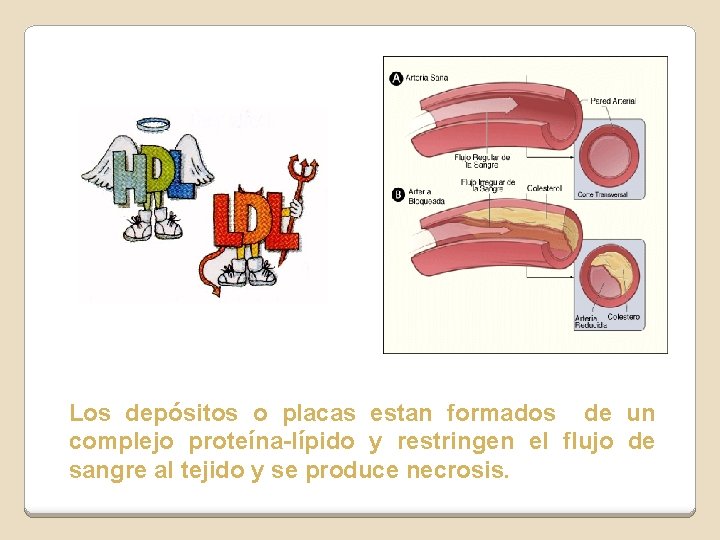 Los depósitos o placas estan formados de un complejo proteína-lípido y restringen el flujo Los depósitos o placas estan formados de un complejo proteína-lípido y restringen el flujo