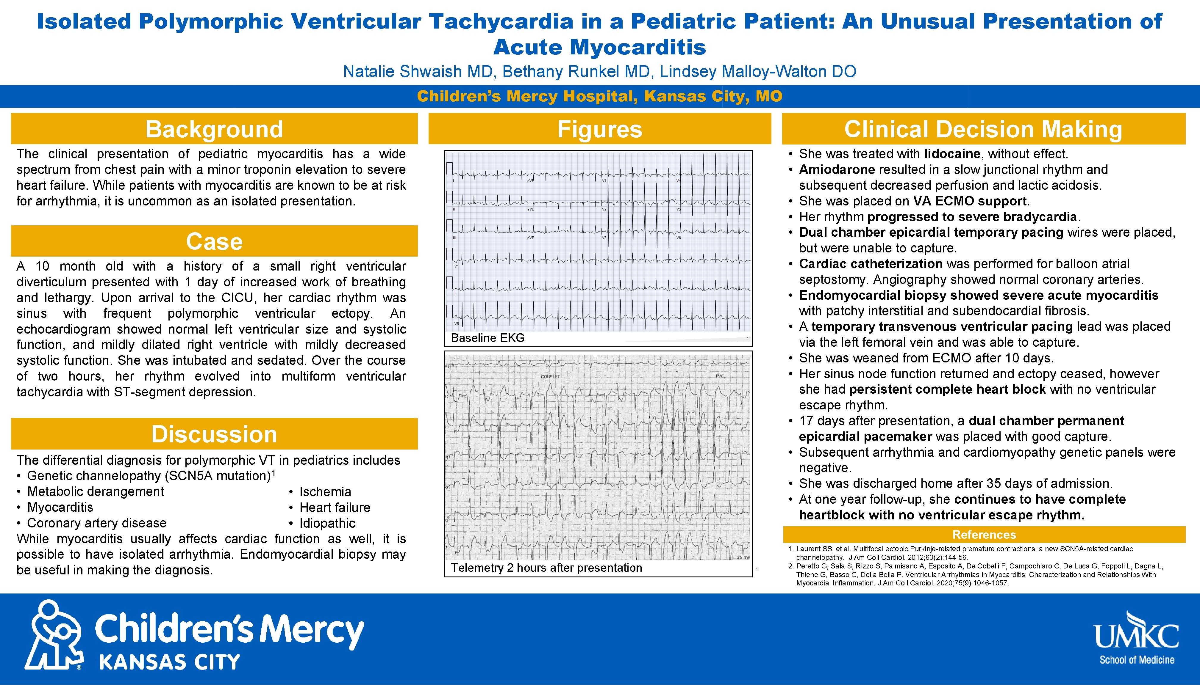Isolated Polymorphic Ventricular Tachycardia in a Pediatric Patient: An Unusual Presentation of Acute Myocarditis