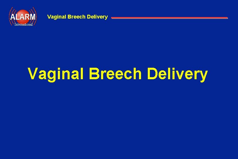 Vaginal Breech Delivery International Vaginal Breech Delivery 