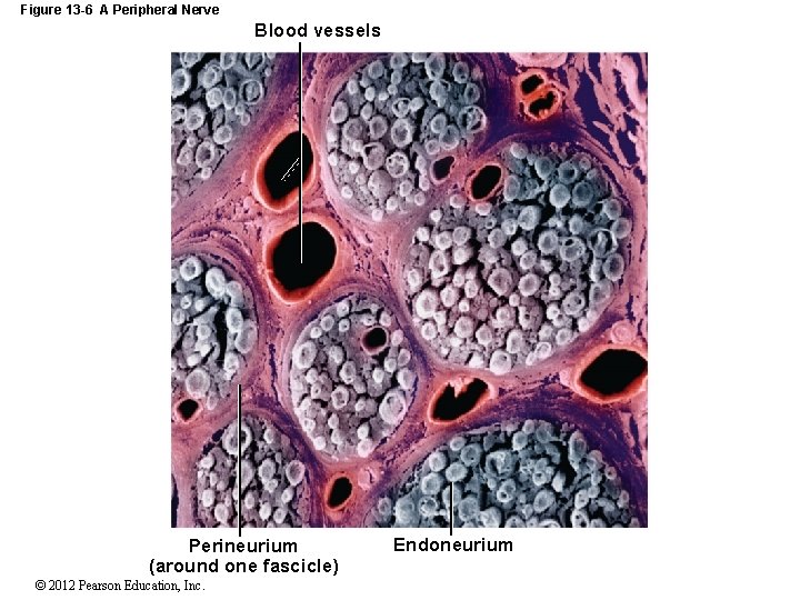 Figure 13 -6 A Peripheral Nerve Blood vessels Perineurium (around one fascicle) © 2012
