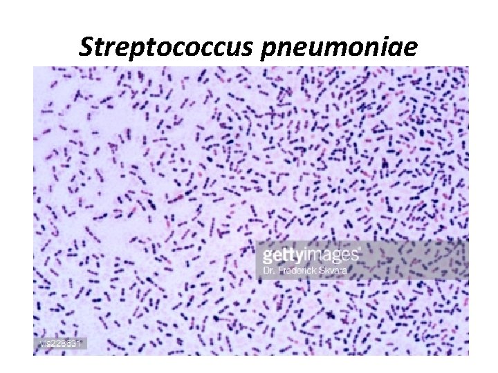 Streptococcus pneumoniae 