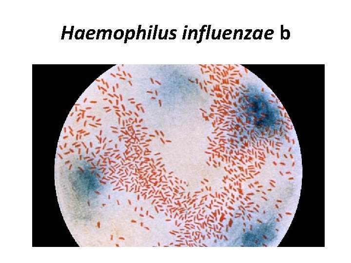 Haemophilus influenzae b 