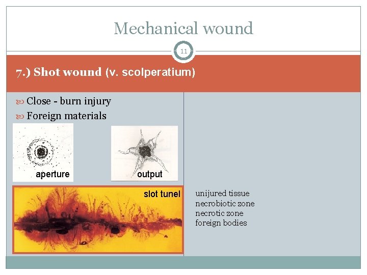 Mechanical wound 11 7. ) Shot wound (v. scolperatium) Close - burn injury Foreign