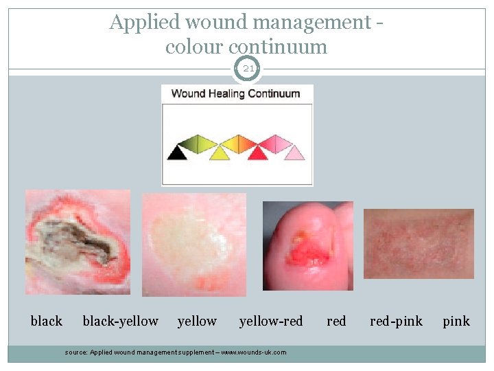 Applied wound management colour continuum 21 black-yellow-red source: Applied wound management supplement – www.