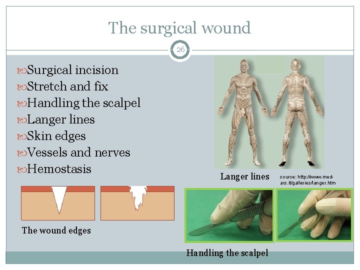 The surgical wound 26 Surgical incision Stretch and fix Handling the scalpel Langer lines