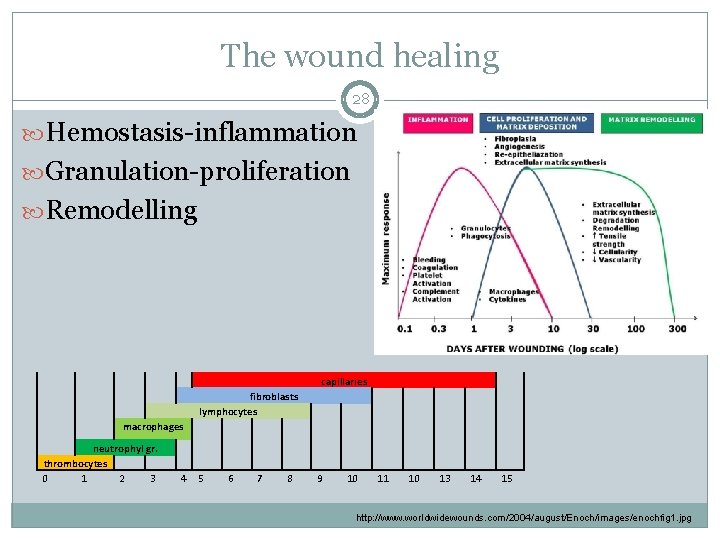 The wound healing 28 Hemostasis-inflammation Granulation-proliferation Remodelling capillaries fibroblasts lymphocytes macrophages neutrophyl gr. thrombocytes