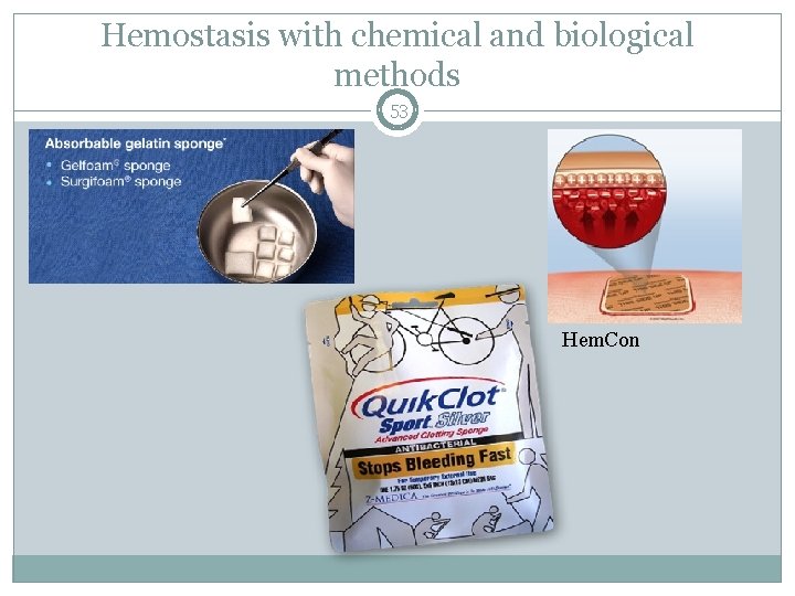 Hemostasis with chemical and biological methods 53 Hem. Con 