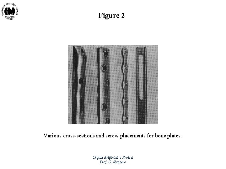 Figure 2 Various cross-sections and screw placements for bone plates. Organi Artificiali e Protesi