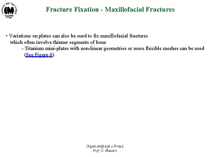 Fracture Fixation - Maxillofacial Fractures • Variations on plates can also be sued to