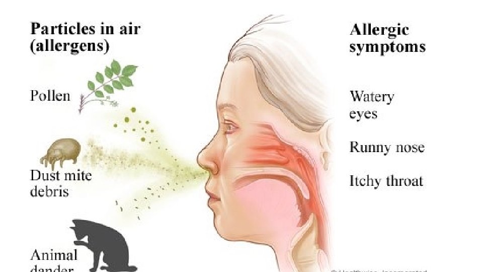 Symptoms of Allergies 