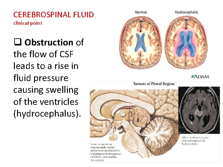 CEREBROSPINAL FLUID clinical point q Obstruction of the flow of CSF leads to a