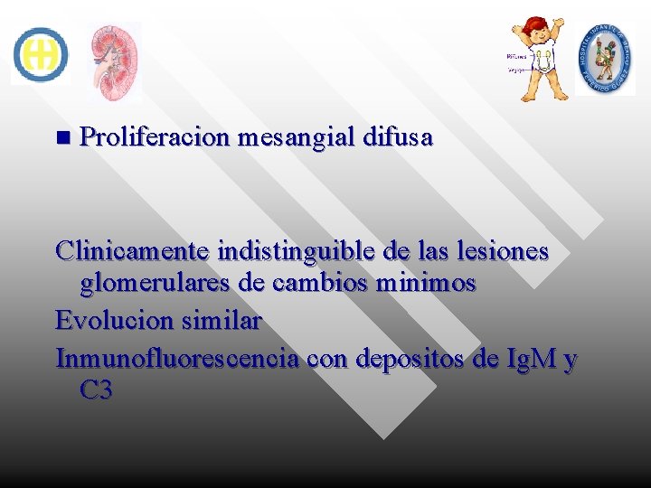 n Proliferacion mesangial difusa Clinicamente indistinguible de las lesiones glomerulares de cambios minimos Evolucion